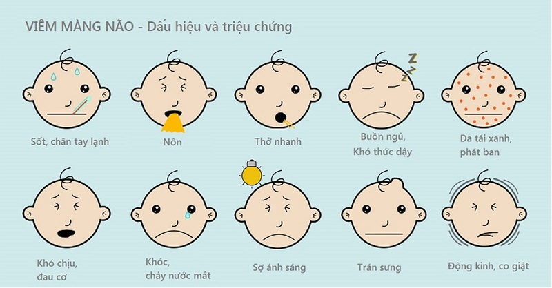 Triệu chứng bệnh viêm màng não virus